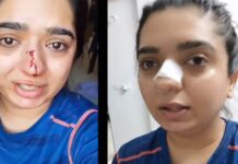 घूसा जड़ने वाले Zamato के डिलीवरी बॉय और एक महिला बीच इस वजह से विवाद हुआ Zomato-delivery-boy-case
