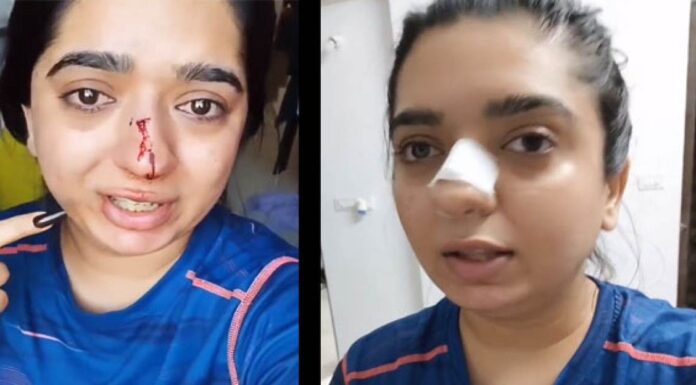 घूसा जड़ने वाले Zamato के डिलीवरी बॉय और एक महिला बीच इस वजह से विवाद हुआ Zomato-delivery-boy-case