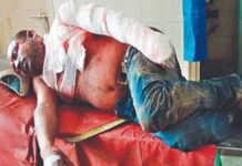 जमीन विवाद में युवक को पेट्रोल छिड़क जिंदा जलाने का प्रयास, बचाने में 3 भाई झुलसे burn-man