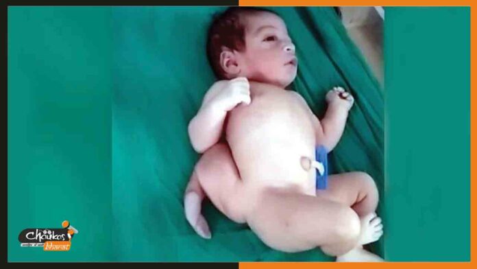 3-pai-3-hath-wala-bachcha