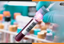 ब्लड टेस्ट से लगेगा स्तन कैंसर का पता, स्पेशल किट हुई लॉन्च Blood Test