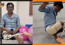 IIT गुवाहाटी ने किया कमाल, एडवांस्ड फीचर्स के साथ विकसित किया प्रोस्ठेटिक पैर Prosthetic Leg