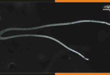 दुनिया के अब तक के सबसे बड़े बैक्टीरिया की हुई खोज Thiomargarita-Magnifica