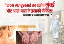 खसरे का प्रकोप मुंबई और आस-पास के इलाकों में फैला: एक महीने में 13 मौतें खसरे का प्रकोप मुंबई और आस-पास के इलाकों में फैला: एक महीने में 13 मौतें